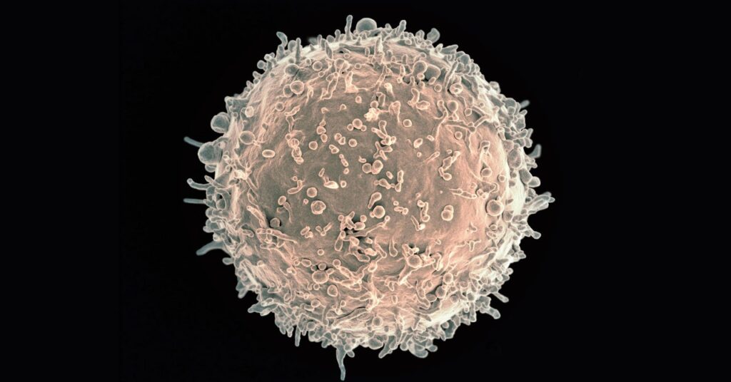 In a World First, a Affected person’s Antibody Cells Had been Simply Genetically Engineered In a World First, a Affected person’s Antibody Cells Had been Simply Genetically Engineered