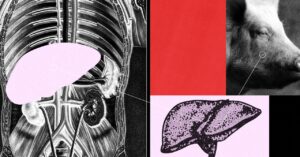 A Gene-Edited Pig Liver Was Connected to a Particular person—and Labored for 3 Days