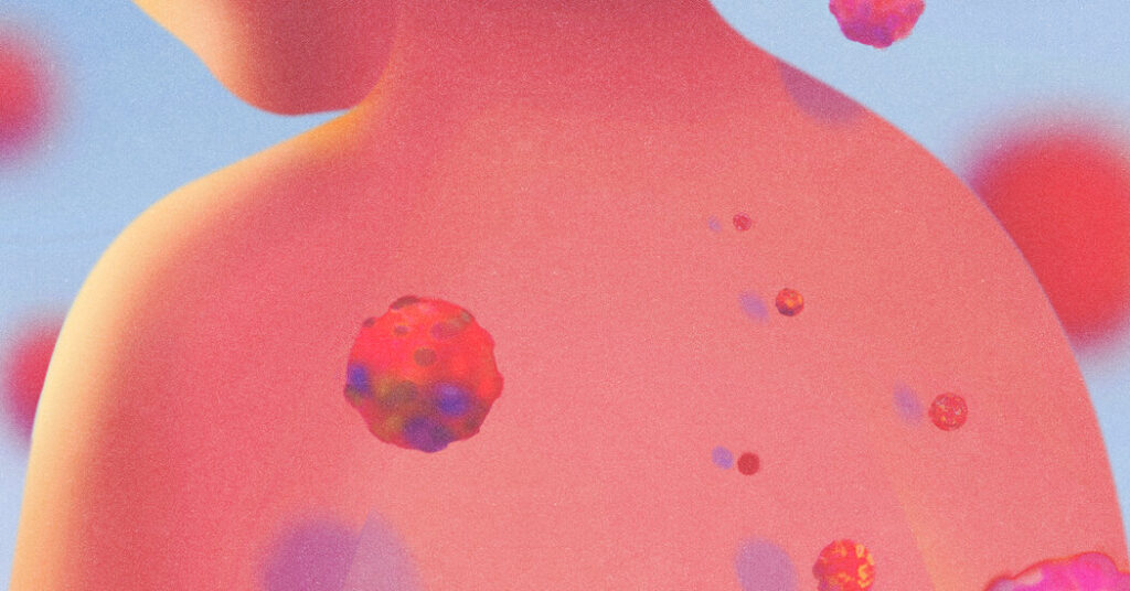 Opinion | The Measles Outbreak in Europe is a Warning to America