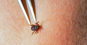 A Capsule That Kills Ticks Is a Promising New Weapon In opposition to Lyme Illness