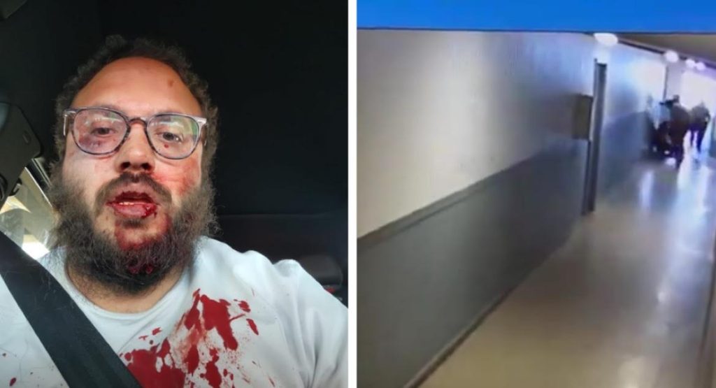 SHOCK VIDEO: Aurora House Employee Crushed Bloody by Venezuelan Tren de Aragua Gang Members | The Gateway Pundit SHOCK VIDEO: Aurora House Employee Crushed Bloody by Venezuelan Tren de Aragua Gang Members | The Gateway Pundit