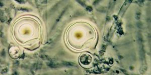 Electrical Fields Can Deter Devastating Crop Parasites