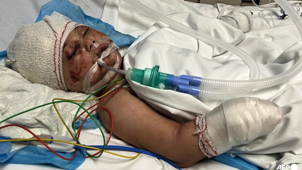 Buried for 14 hours after Israeli strike, Lebanese toddler makes restoration