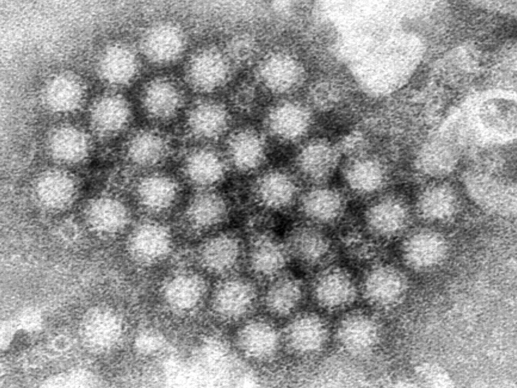 Norovirus is spiking within the US: What do we have to know? | Well being Information