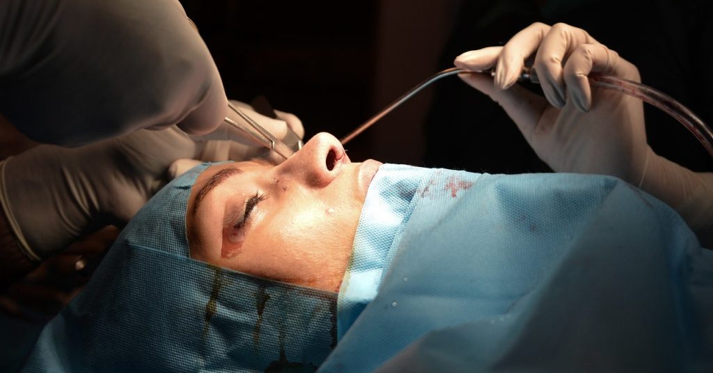 These Newly Recognized Cells May Change the Face of Plastic Surgical procedure