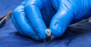 This Blood Vessel Was Grown in a Lab With Actual Human Cells