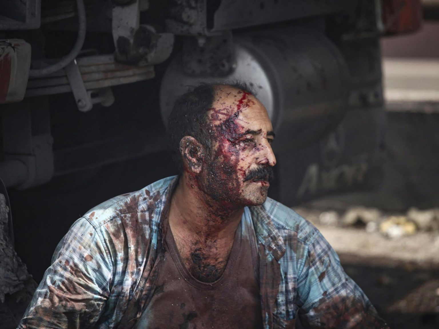 Lethal explosion shakes Iran, a whole lot hospitalised after port fireplace | Gallery Information Lethal explosion shakes Iran, a whole lot hospitalised after port fireplace | Gallery Information