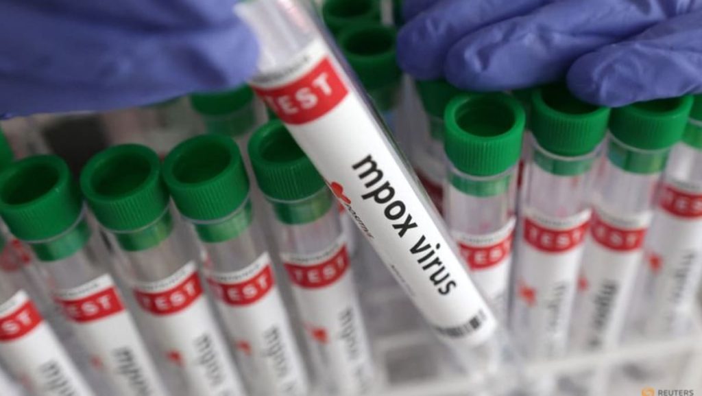 Sierra Leone faces rise in mpox circumstances Sierra Leone faces rise in mpox circumstances