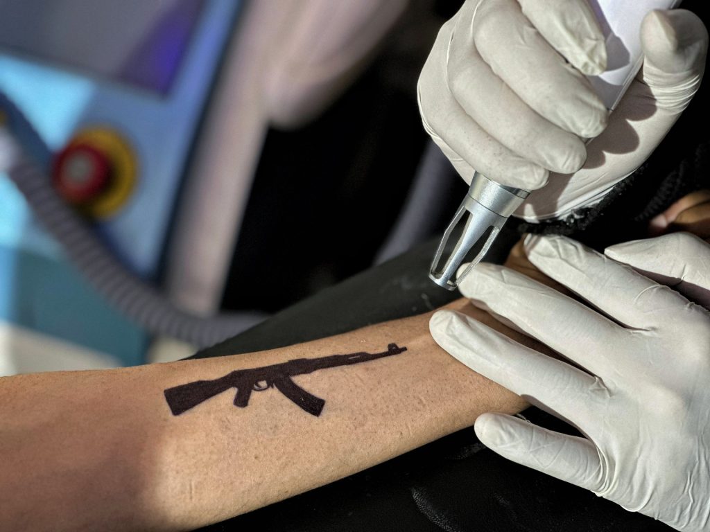 ‘Concern is actual’: Why younger Kashmiris are eradicating tattoos of weapons, ‘freedom’ | India-Pakistan Tensions