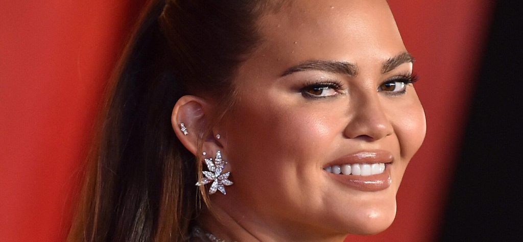 Chrissy Teigen Sparks Concern After Sharing Alarming New Picture