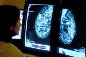 Breast most cancers: Indicators, signs and how one can test your self at residence
