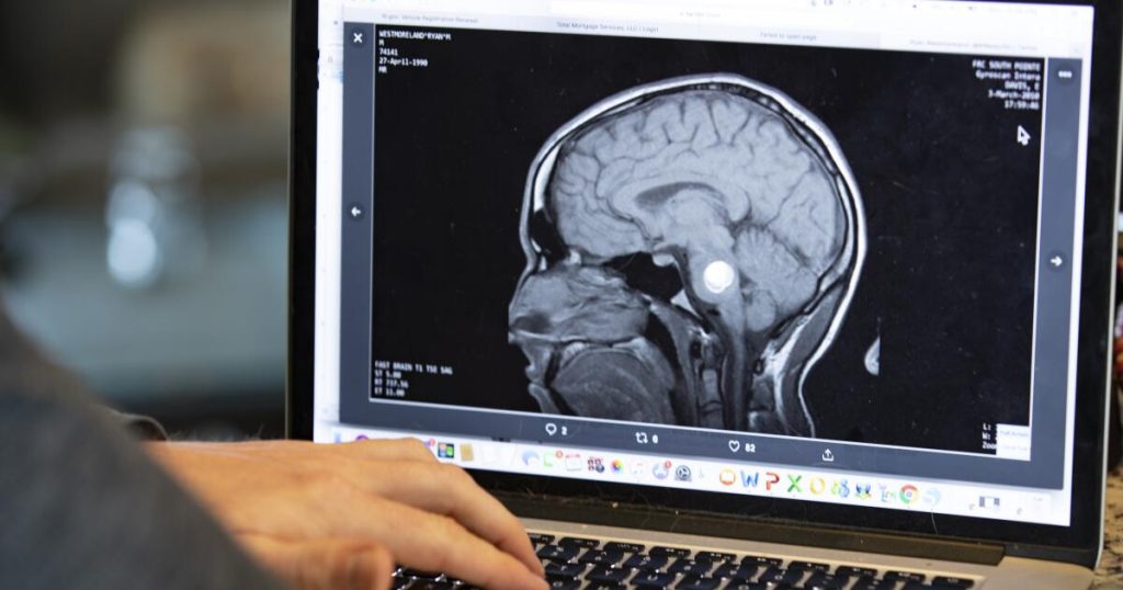 Some AI fashions are studying tips on how to clear up issues like people do