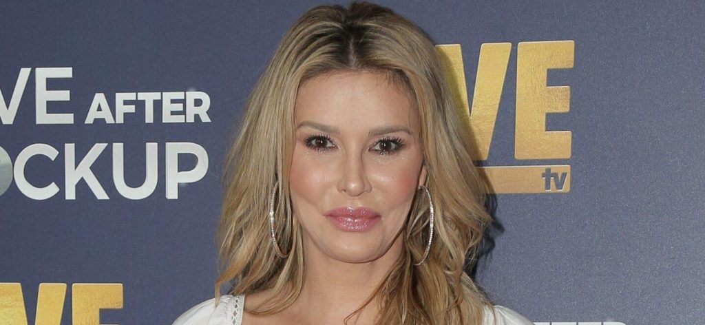 One other Bravo Star Complains Of Brandi Glanville’s Face Parasite One other Bravo Star Complains Of Brandi Glanville’s Face Parasite