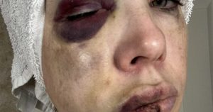 Senator Bernie Moreno Releases Horrific Pictures of Cincinnati Mob Beating Sufferer | The Gateway Pundit