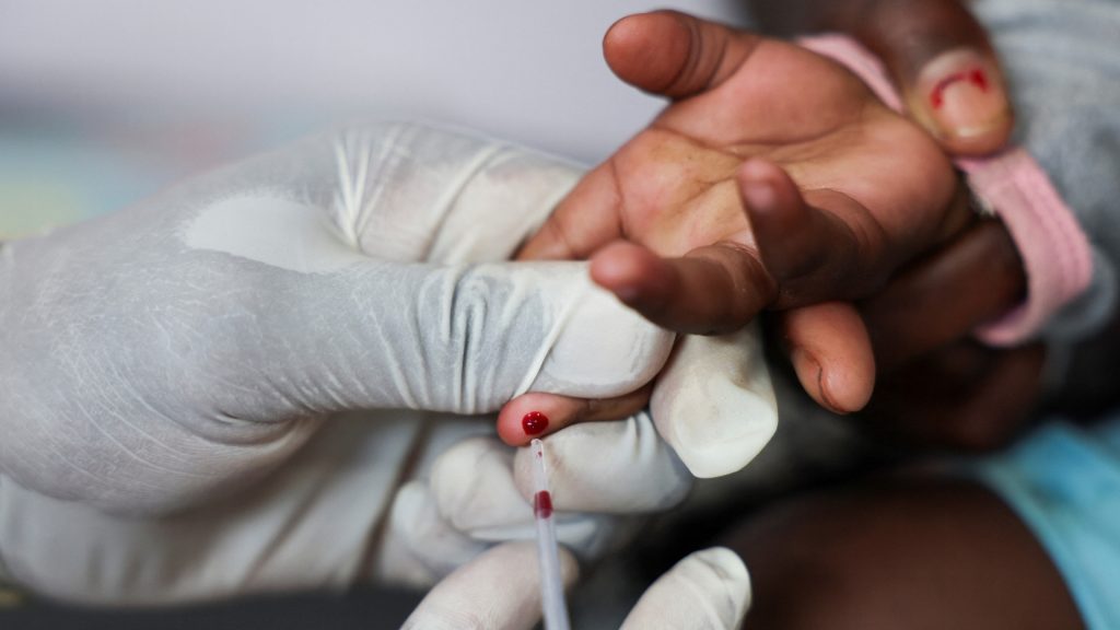 How can nations save the lives of individuals dwelling with HIV? | Well being How can nations save the lives of individuals dwelling with HIV? | Well being