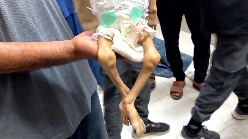 What has Israel’s denial of meals performed to Gaza’s folks? | Israel-Palestine battle