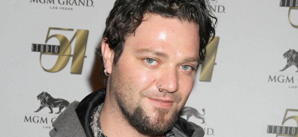 Bam Margera Reveals Alcohol Habit Almost Destroyed His Legs Bam Margera Reveals Alcohol Habit Almost Destroyed His Legs