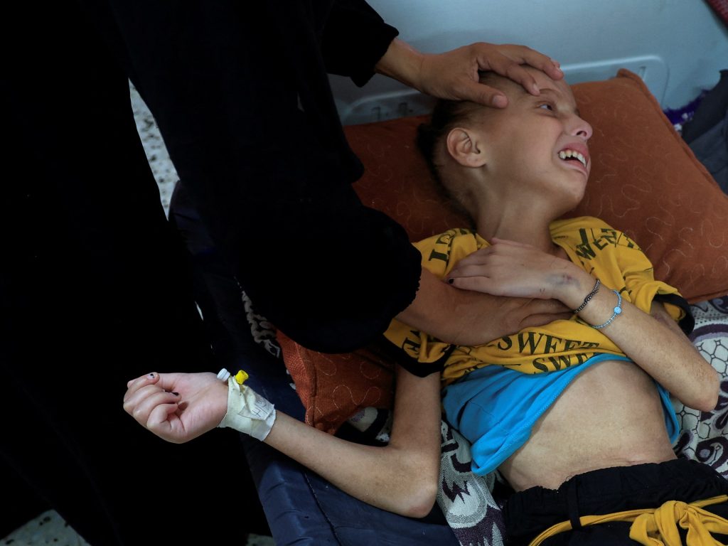 Tens of hundreds of Palestinian kids ravenous in Gaza tent camps | Israel-Palestine battle Information Tens of hundreds of Palestinian kids ravenous in Gaza tent camps | Israel-Palestine battle Information