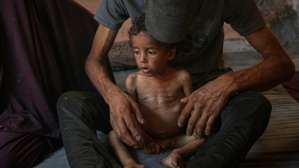 Why are Israelis ‘in no way troubled’ by hunger in Gaza? | Israel-Palestine battle Information