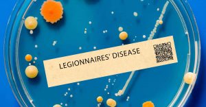Legionnaires’ Illness Outbreak Leaves One Useless, Extra Than 40 Contaminated in London, Ontario